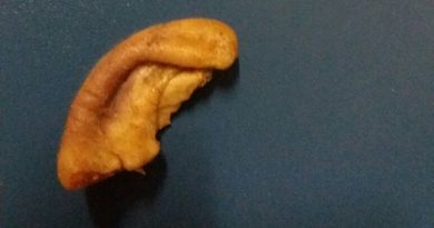 Homem defende mulher durante briga e tem orelha arrancada com mordida em Caarapó