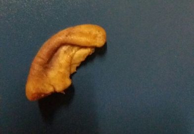 Homem defende mulher durante briga e tem orelha arrancada com mordida em Caarapó